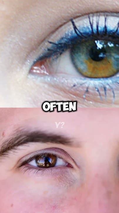heterochromia pinay|Heterochromia: Why Do Some People Have Differently.